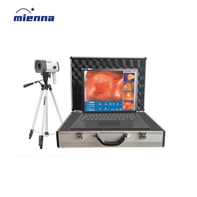 Colposcopio electrónico digital para ginecología quirúrgica